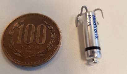 Hospital San José hace historia al implantar el marcapaso más pequeño del mundo
