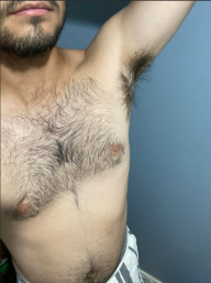 JuanPeludo23