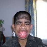 negro pelon