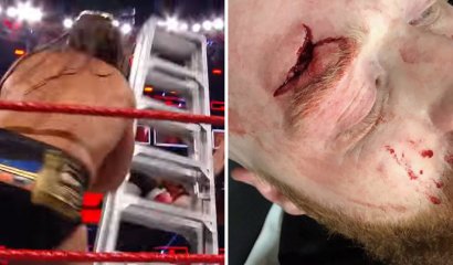 Un fallido truco con escalera le provocó un corte profundo ex campeón de la WWE