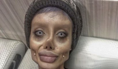 Quería ser igual a Angelina Jolie y terminó pareciéndose al "cadáver de la novia"