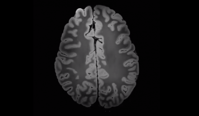 [VIDEO] Capturan imagen nunca antes vista del cerebro humano