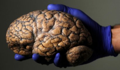 Científicos ya saben cómo volver a la vida a un cerebro humano muerto