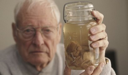 El robo del cerebro de Einstein