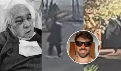"el ojo, al parecer, se perdió al 100%": el devastador diagnóstico de conserje golpeado en Vitacura